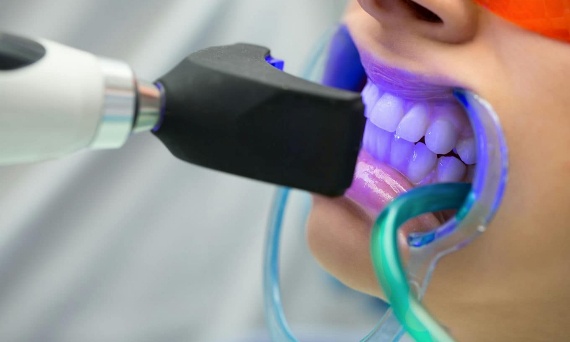 Jakie są dostępne rozmiary rozwieraków dentystycznych?